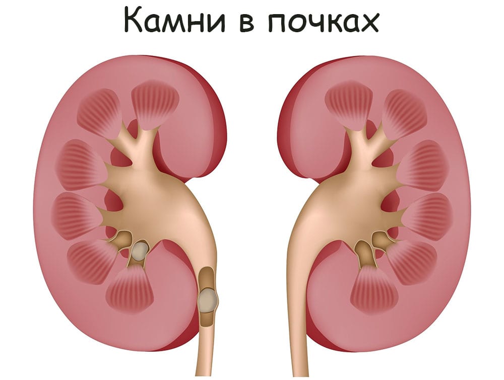 Кракен сайт бошки